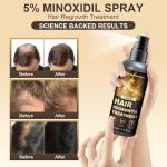 Minoxidil Spray - 5% Minoxidil for Men, Minoxidil for Women Hair Growth Products, Extra Strength Hair Regrowth Devices with Biotin, Help to Stop Loss Hair Unscented Light and non Greasy 3.38 Fl.OZ