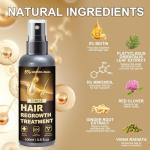 Minoxidil Spray - 5% Minoxidil for Men, Minoxidil for Women Hair Growth Products, Extra Strength Hair Regrowth Devices with Biotin, Help to Stop Loss Hair Unscented Light and non Greasy 3.38 Fl.OZ