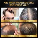 Minoxidil for Men & Women, With Biotin, Batana Oil, Rosemary Essential Oil, Effective Hair Loss Solution, Hair Loss Treatment for Hair Regrowth, Non-Greasy 5% Minoxidil - 60ml(Single Bottle Serum)