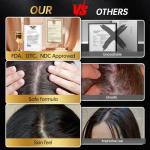 Minoxidil for Men & Women, With Biotin, Batana Oil, Rosemary Essential Oil, Effective Hair Loss Solution, Hair Loss Treatment for Hair Regrowth, Non-Greasy 5% Minoxidil - 60ml(Single Bottle Serum)