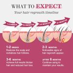 5% Minoxidil for Women Hair Regrowth Spray, hers hair regrowth treatment Infused with Biotin, Extra Strength Treatment to Combat Hair Loss and Thinning, 3 Bottles