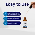 Hair Aura Topical Melatonin for Hair Loss | Hair Loss Fighting Formula with Melatonin, Biotin & Ginkgo Biloba | Paraben and Gluten Free | For Men and Women | 2oz