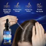 5% Minoxidil Hair Growth for Men and Women: Extra Strength Minoxidil Topical Solution for Adults with Receding Hairlines or Vertex Thinning - Hair Loss Treatment Serum with Biotin for Daily Scalp Use