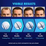 5% Minoxidil Hair Growth for Men and Women: Extra Strength Minoxidil Topical Solution for Adults with Receding Hairlines or Vertex Thinning - Hair Loss Treatment Serum with Biotin for Daily Scalp Use