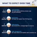 5% Minoxidil Hair and Beard Growth Kit: Extra Strength Minoxidil Topical Hair Regrowth Treatments Serum for Thinning Hair - Hair Loss Products for Men and Women