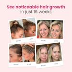 Trybello Hair Growth Shampoo | Natural Hair Thickening & Scalp Detox | Sulfate Free, Vegan, Anti-Hair Fall Formula | Caffeine, Aloe Vera, Turmeric, and Urucum Extract | For Any Hair Type