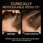 5% Minoxidil Hair Growth Serum for Women: Extra Strength Hair Loss Treatment with Biotin for Thinning Hair - Regrowth Topical Solution to Restore Follicle Health & Thicker Results