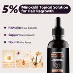 5% Minoxidil Hair Growth Serum for Women: Extra Strength Hair Loss Treatment with Biotin for Thinning Hair - Regrowth Topical Solution to Restore Follicle Health & Thicker Results