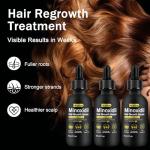 5% Minoxidil for Men and Women Hair Growth Treatment,Topical Minoxidil for Beard Growth, Hair Regrowth Serum for Scalp Hair Loss and Thinning, with Biotin (3Pack)