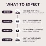 5% Minoxidil Hair Growth Serum for Women: Extra Strength Hair Loss Treatment with Biotin for Thinning Hair - Regrowth Topical Solution to Restore Follicle Health & Thicker Results