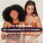 5% Minoxidil Hair Growth Serum for Women: Extra Strength Hair Loss Treatment with Biotin for Thinning Hair - Regrowth Topical Solution to Restore Follicle Health & Thicker Results