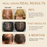 Laser Hair Growth Comb, Hair Growth Device, promote hair growth in women and men, Black