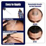 5% Minoxidil for Men Hair Growth with Biotin, 100ML Topical Minoxidil Solution Serum with Rosemary & Caffeine for Hair Regrowth Treatments, Non-Greasy, Helps Prevent Hair Thinning & Hair Loss