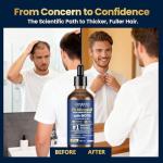 5% Minoxidil for Men Hair Growth with Biotin, 100ML Topical Minoxidil Solution Serum with Rosemary & Caffeine for Hair Regrowth Treatments, Non-Greasy, Helps Prevent Hair Thinning & Hair Loss