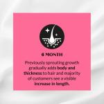 Kerotin Hair Growth Vitamins, Biotin Supplement, DHT Blocker, Collagen Stimulator, for Hair Loss Support, Nail & Skin Care, Includes Saw Palmetto, Vitamin D3 & More - 60 Pills (1 Month Supply)