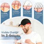 Red Light Hair Growth Device,Laser Hair Growth Cap, Red Light Therapy for Hair Growth, Red Light Cap for Thicker Hair in Men and Women