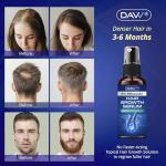 5% Minoxidil Spray for Women and Men Hair Growth: Minoxidil for Women Hair Growth - Minoxidil for Men - Extra Strength Hair Regrowth Treatment - Hair Growth Serum for Faster Stronger Thicker - 60ML