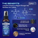 5% Minoxidil Spray for Women and Men Hair Growth: Minoxidil for Women Hair Growth - Minoxidil for Men - Extra Strength Hair Regrowth Treatment - Hair Growth Serum for Faster Stronger Thicker - 60ML