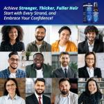 5% Minoxidil Spray for Women and Men Hair Growth: Minoxidil for Women Hair Growth - Minoxidil for Men - Extra Strength Hair Regrowth Treatment - Hair Growth Serum for Faster Stronger Thicker - 60ML