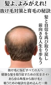 Hair Regrow Secrets to Stop Hair Loss and Promote Growth Balding Thinning Hair Regrowth Treatment Shampoo Baldness (Japanese Edition)
