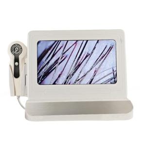 Professional Scalp Camera with 11-Inch HD Screen - High-Definition Hair & Scalp Analysis Device for Salons and Spas, Easy to Use, Ideal for Scalp Care & Client Consultations