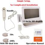 Professional Scalp Camera with 11-Inch HD Screen - High-Definition Hair & Scalp Analysis Device for Salons and Spas, Easy to Use, Ideal for Scalp Care & Client Consultations