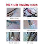 Professional Scalp Camera with 11-Inch HD Screen - High-Definition Hair & Scalp Analysis Device for Salons and Spas, Easy to Use, Ideal for Scalp Care & Client Consultations