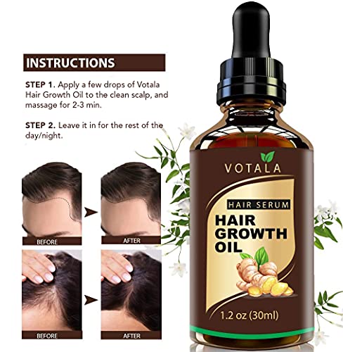 VOTALA Hair Growth Serum for Thicker, Stronger Hair