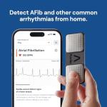 KardiaMobile EKG Monitor – AFib Detection in 30s