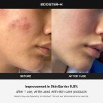 Medicube Booster H - Needle-Free Facial Glow Tool