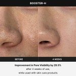 Medicube Booster H - Needle-Free Facial Glow Tool