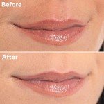 Rose Gold Electric Facial Hair Remover for Women