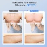 Painless IPL Laser Hair Removal with Ice Cooling