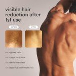 Nood Flasher Pro IPL Hair Removal Device