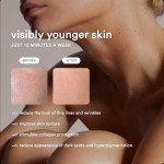 Nood Flasher Pro IPL Hair Removal Device