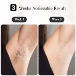 JOVS IPL Laser Hair Removal with Cooling Tech