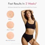 Ulike Air 10 IPL Laser Hair Removal Device