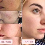 Australian Pink Clay Detox Mask with Vitamin C