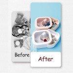 4-Piece Stackable Hair Tie Organizer Set
