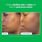 Paula's Choice Vegan Azelaic Acid Brightening Serum