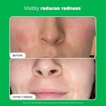 Paula's Choice Vegan Azelaic Acid Brightening Serum