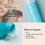 Paula's Choice Vegan Acne Face Wash, 6 Fl Oz