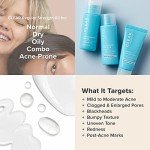 Paula's Choice Vegan Acne Relief Travel Kit