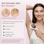 Finequin Laser Hair Removal Device with Ice-Cooling