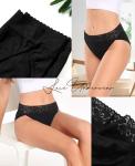 Cotton Lace High Cut Bikini Panties for Women