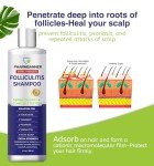 Vegan Anti-Fungal Shampoo for Scalp Relief