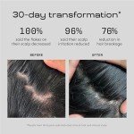 Vegan Zinc Anti-Dandruff Shampoo for All Scalp Types