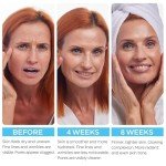 Vegan Retinol Cream with Hyaluronic Acid and Collagen