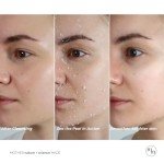 Gentle Vegan Exfoliating Facial Peeling Gel 3.38 fl. oz