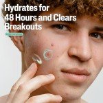 Vegan Mattifying Face Moisturizer for Acne-Prone Skin